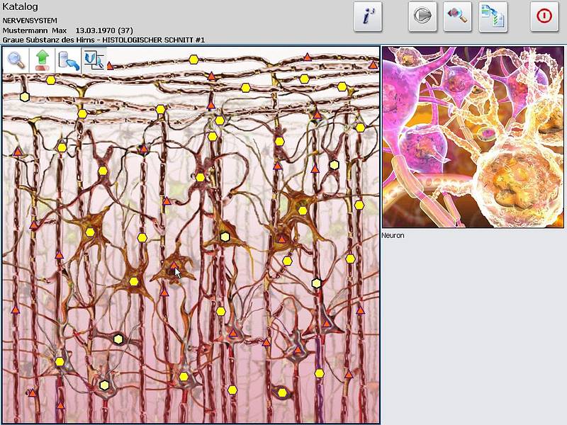 Graue Substanz des Gehirns